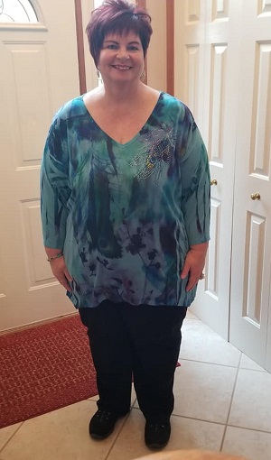 sheila after photo