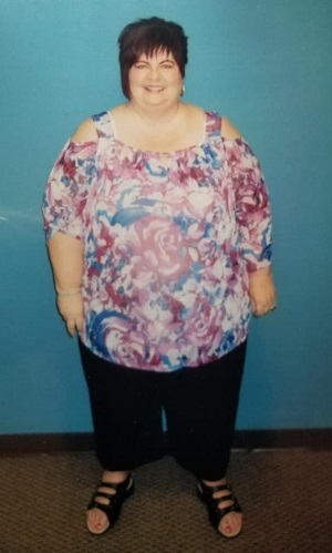 sheila before picture